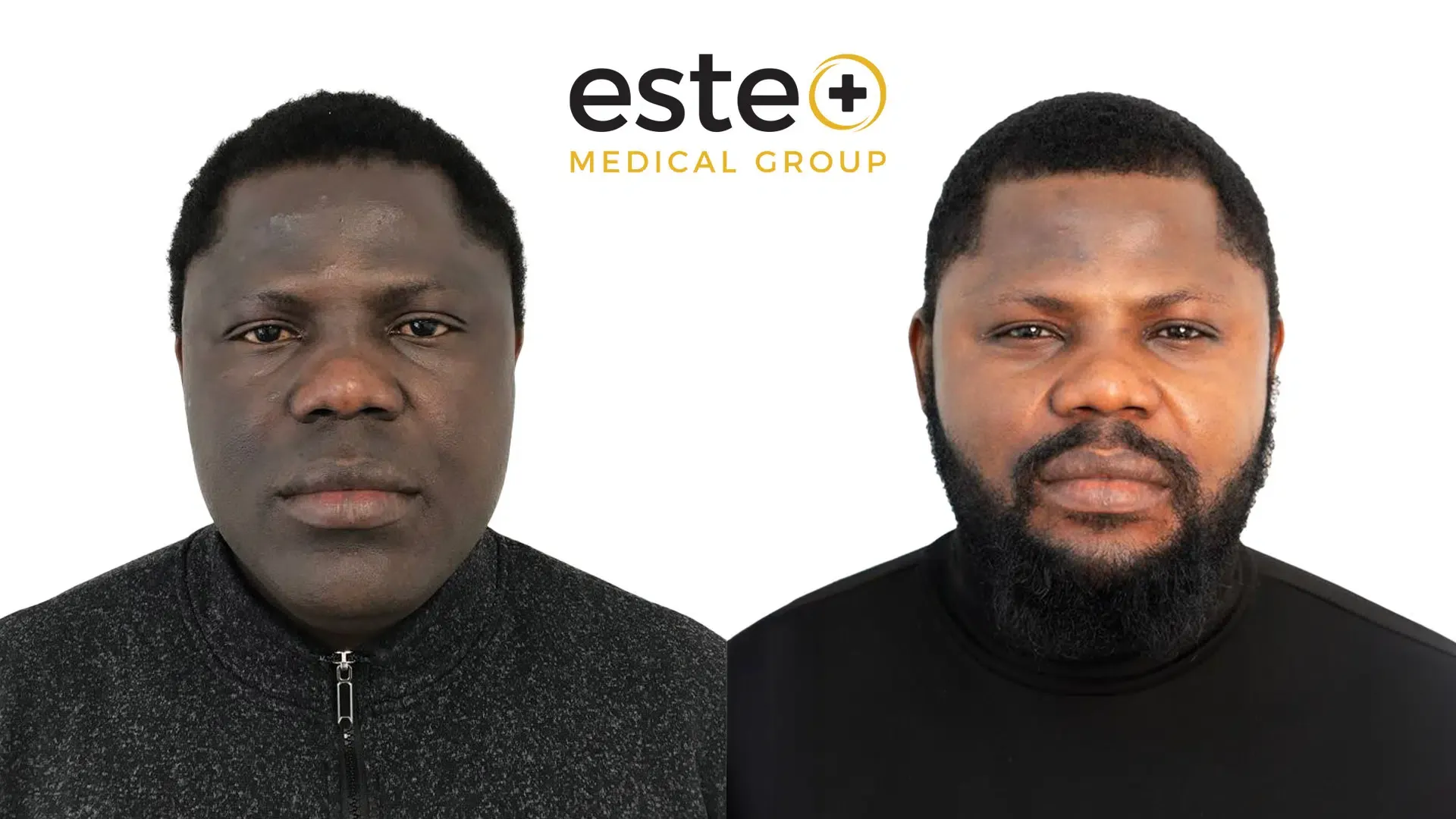 before and after result